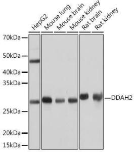 Western blot analysis of extracts of various cell lines, using Anti-DDAH2 Antibody [ARC0910] (A307398) at 1:1,000 dilution. The secondary antibody was Goat Anti-Rabbit IgG H&L Antibody (HRP) at 1:10,000 dilution.