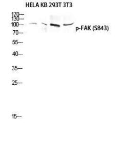 Western blot analysis of HELA KB 293T 3T3 lysis using Anti-FAK (phospho Ser843) Antibody