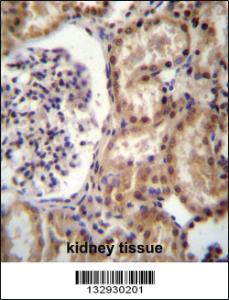 Anti-RNF43 Rabbit Polyclonal Antibody