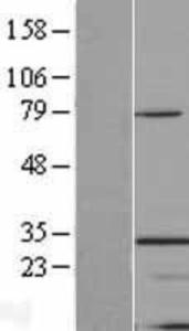 Anti-SEMA3B Rabbit Polyclonal Antibody