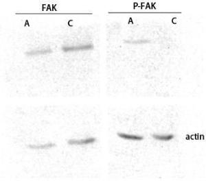 Western blot analysis of customer's lysis using Anti-FAK (phospho Ser843) Antibody