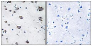 Antibody anti-AIFM3 100 µg