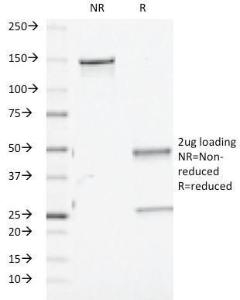 SDS-PAGE analysis of Anti-TGF beta Antibody [TGFB/510] under non-reduced and reduced conditions; showing intact IgG and intact heavy and light chains, respectively. SDS-PAGE analysis confirms the integrity and purity of the antibody.