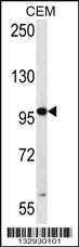 Anti-RNF43 Rabbit Polyclonal Antibody