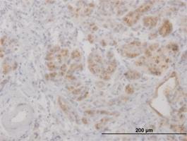 Anti-LCN2 Mouse Polyclonal Antibody