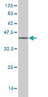 Anti-PCDH1 Mouse Monoclonal Antibody [clone: 2E8]