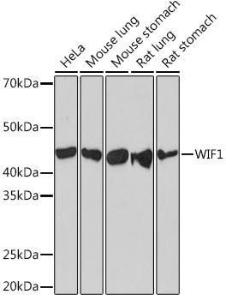 Western blot analysis of extracts of various cell lines, using Anti-WIF1 Antibody [ARC1161] (A308357) at 1:1,000 dilution The secondary antibody was Goat Anti-Rabbit IgG H&L Antibody (HRP) at 1:10,000 dilution Lysates/proteins were present at 25 µg per lane