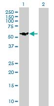 Anti-DIXDC1 Mouse Polyclonal Antibody