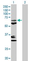 Anti-MTPAP Rabbit Polyclonal Antibody