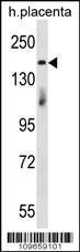 Anti-INTS1 Rabbit Polyclonal Antibody (FITC (Fluorescein Isothiocyanate))