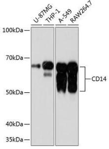 Anti-CD14 Rabbit Monoclonal Antibody [clone: ARC0353]