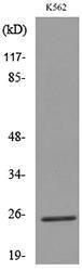 Western blot analysis of lysate from K562 cells using Anti-CD7 Antibody