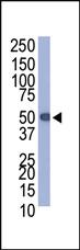 Anti-Protein-C Tag Rabbit Polyclonal Antibody