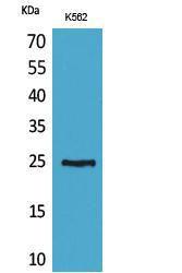 Western blot analysis of K562 cells using Anti-CD7 Antibody