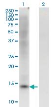 Anti-ZBTB16 Mouse Monoclonal Antibody [clone: 1F10]