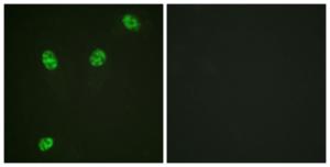 Immunofluorescence analysis of HeLa cells using Anti-ERF (phospho Thr526) Antibody. The right hand panel represents a negative control, where the antibody was pre-incubated with the immunising peptide.