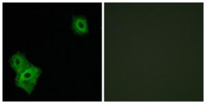 Antibody anti-AIFM3 100 µg