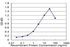 Anti-ZBTB16 Mouse Monoclonal Antibody [clone: 1F10]