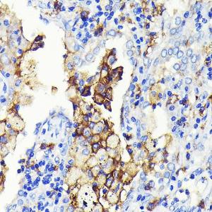 Anti-CD14 Rabbit Monoclonal Antibody [clone: ARC0353]