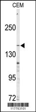 Anti-ABCC4 Rabbit Polyclonal Antibody