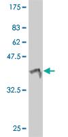 Anti-ERBB2 Mouse Monoclonal Antibody [clone: 3B1]