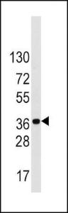 Anti-LDLRAP1 Rabbit Polyclonal Antibody (AP (Alkaline Phosphatase))