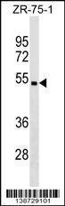 Anti-CHST5 Rabbit Polyclonal Antibody (HRP (Horseradish Peroxidase))