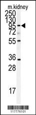 Anti-BCL2 Rabbit Polyclonal Antibody