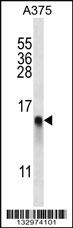 Anti-RPL34 Rabbit Polyclonal Antibody