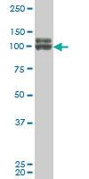 Anti-DDX54 Mouse Monoclonal Antibody [clone: 2E4]