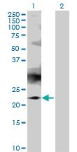 Anti-RAB7B Mouse Polyclonal Antibody