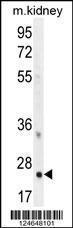 Anti-HOXB6 Rabbit Polyclonal Antibody (Biotin)