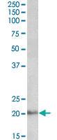 Anti-DCTN3 Goat Polyclonal Antibody