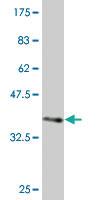 Anti-PCDH1 Mouse Monoclonal Antibody [clone: 2E6]