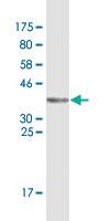 Anti-CSE1L Mouse Monoclonal Antibody [clone: 1C4]