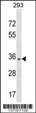 Anti-NUBP1 Rabbit Polyclonal Antibody (Biotin)