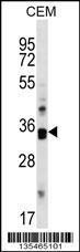 Anti-CDK10 Rabbit Polyclonal Antibody (FITC (Fluorescein Isothiocyanate))