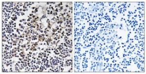 Immunohistochemical analysis of paraffin-embedded human lymph node tissue using Anti-PGLS Antibody. The right hand panel represents a negative control, where the antibody was pre-incubated with the immunising peptide