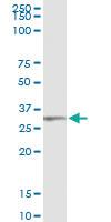 Anti-TRIM72 Polyclonal Antibody Pair