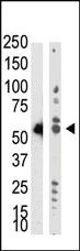 Anti-TRDMT1 Rabbit Polyclonal Antibody