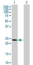 Anti-RAB7B Rabbit Polyclonal Antibody