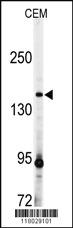 Anti-UBE2E2 Rabbit Polyclonal Antibody