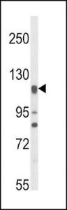 Anti-NOS3 Rabbit Polyclonal Antibody (HRP (Horseradish Peroxidase))