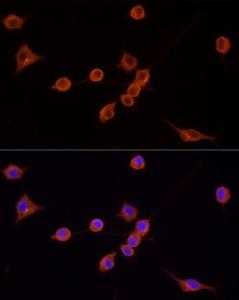 Immunofluorescence analysis of NIH/3T3 cells using Goat Anti-mouse IgG H&L Antibody (TRITC) (A17332) at a dilution of 1:200 (40x lens). DAPI was used to stain the cell nuclei (blue).