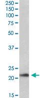 Anti-TMEM205 Goat Polyclonal Antibody