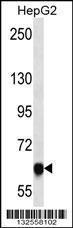 Anti-MAGED4B Rabbit Polyclonal Antibody (PE (Phycoerythrin))