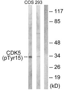 Western blot analysis of lysates from COS7 cells treated with EGF 200ng/ml 30' and 293 cells treated with H2O2 100u, 15mins using Anti-CDK5 (phospho Tyr15) Antibody. The right hand lane represents a negative control, where the antibody is blocked by the immunising peptide.