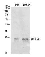 Anti-AICDA Rabbit Polyclonal Antibody