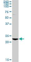 Anti-RAB7B Rabbit Polyclonal Antibody