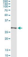 Anti-TRIM72 Antibody Pair